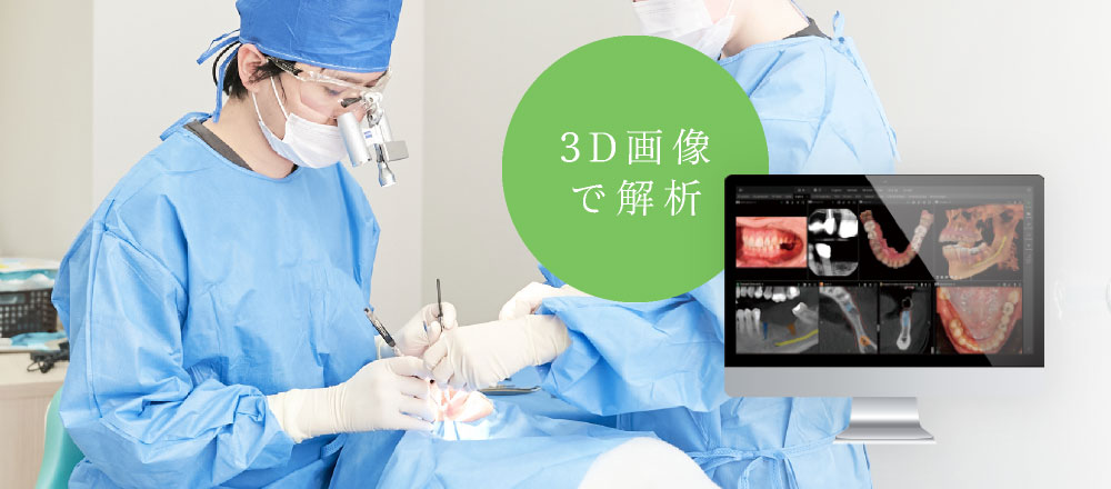 3D画像で解析
