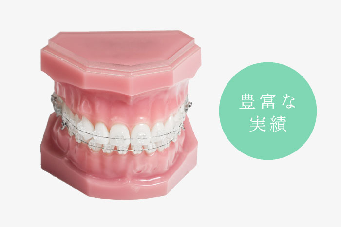 豊富な実績